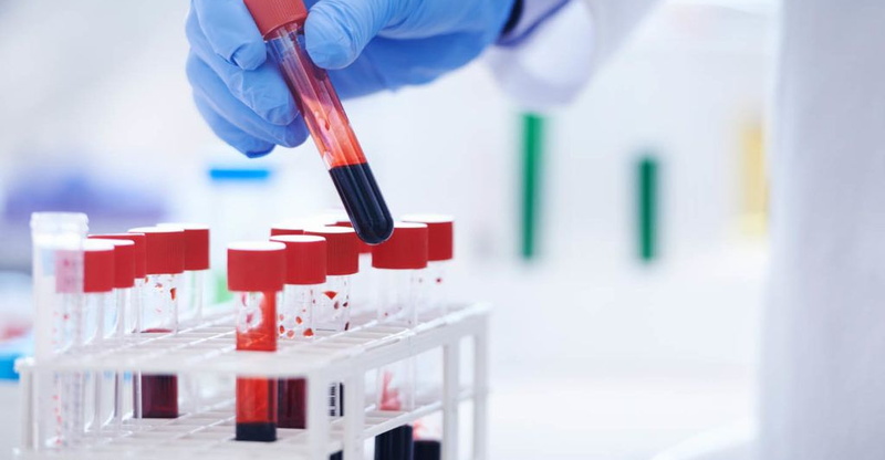 Скидка 30% на анализы по воскресеньям